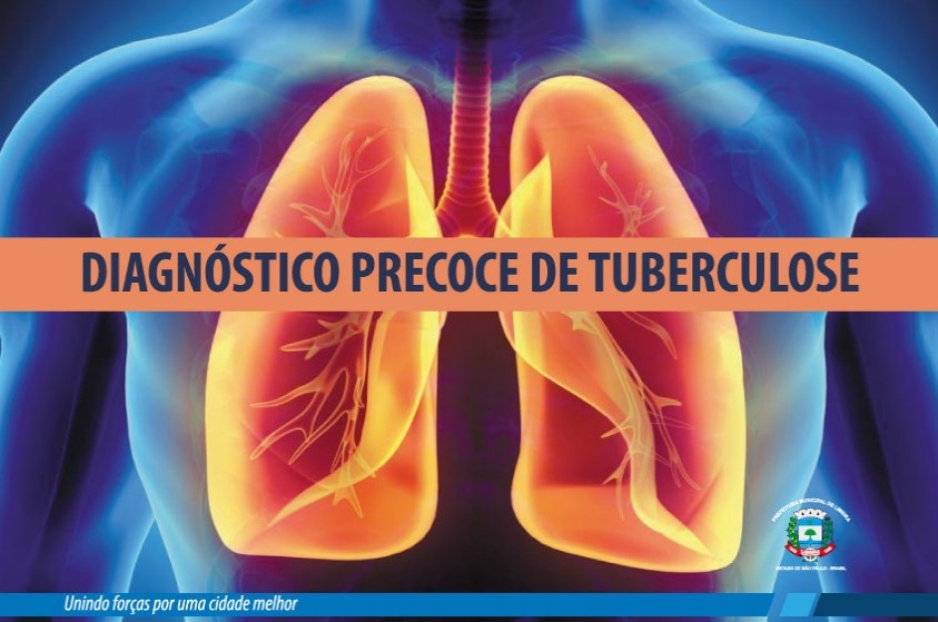 Prefeitura lança campanha de prevenção à tuberculose
